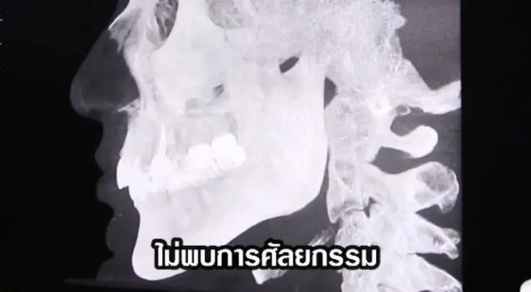 -ดาวิกา-เคลียร์ชัด-หลังพลีชีพสแกนใบหน้า-ฝ่าคำวิจารณ์ทำศัลยกรรม-7