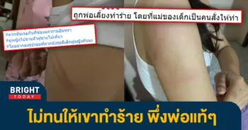 1พ่อเลี้ยงทำร้าย