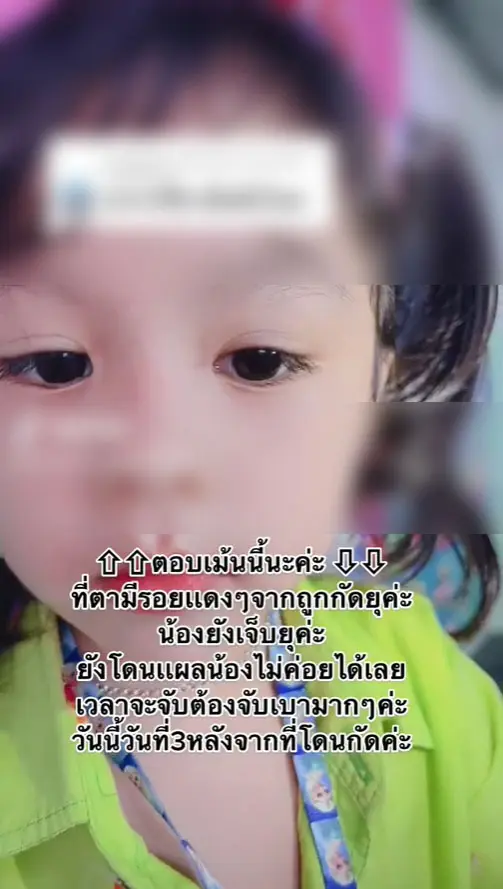 ลูกถูกเห็บกัด-5