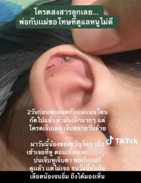 ลูกถูกเห็บกัด-3