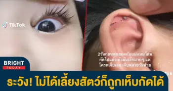 ลูกถูกเห็บกัด