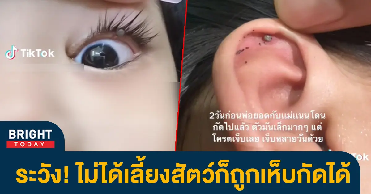 ลูกถูกเห็บกัด