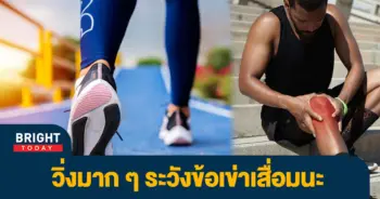 เข่าเสื่อม