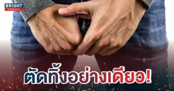 -อัณฑะบิดขั้ว