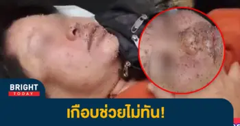 ตายายถูกผึ้งต่อย-2