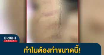 -ครูตบหน้าเด็ก
