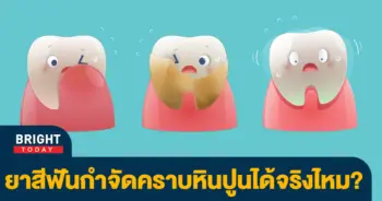 หินปูน-1