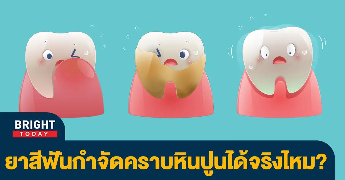 หินปูน-1