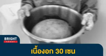 หน้าปกไบรท์-เนื้องอกในมดลูก