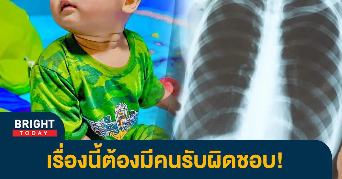ปอดอักเสบ-2