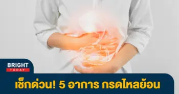 กรดไหลย้อน