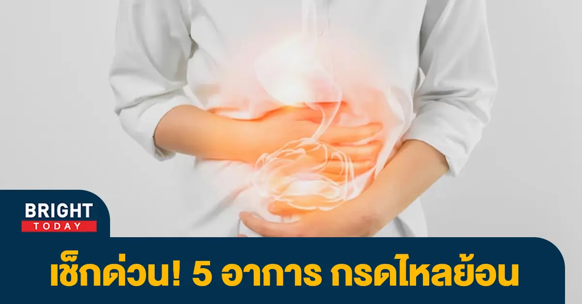 กรดไหลย้อน