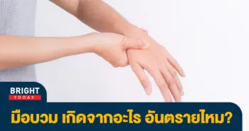 มือบวม
