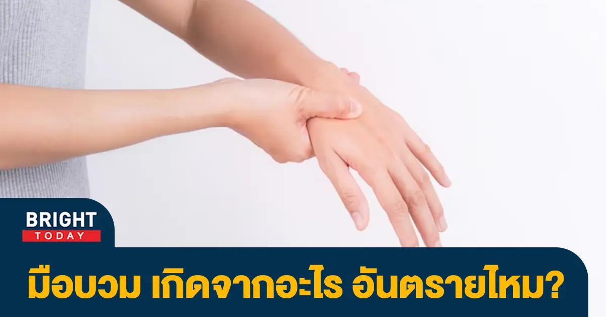 มือบวม