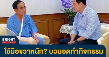 ประยุทธ์มือขวาบวม