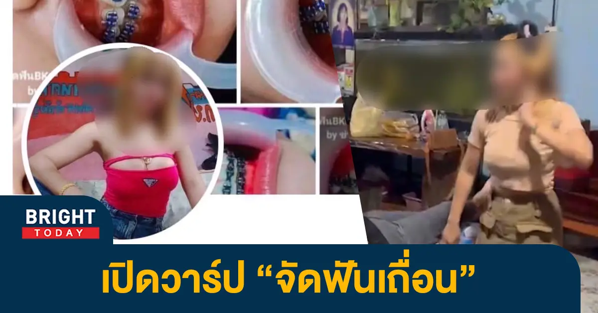 สาวไลฟ์สด-จัดฟัน