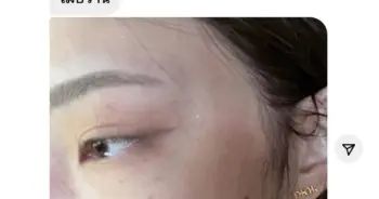 ทำร้าย