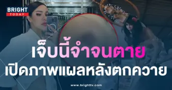 นัท-1
