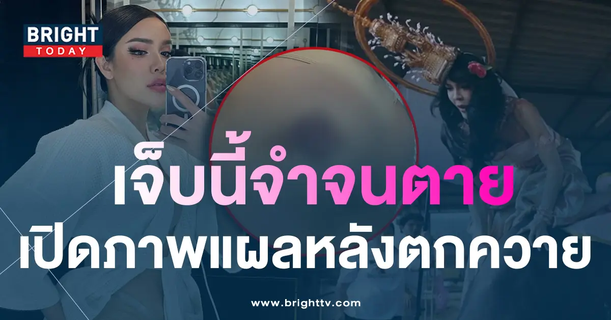 นัท-1