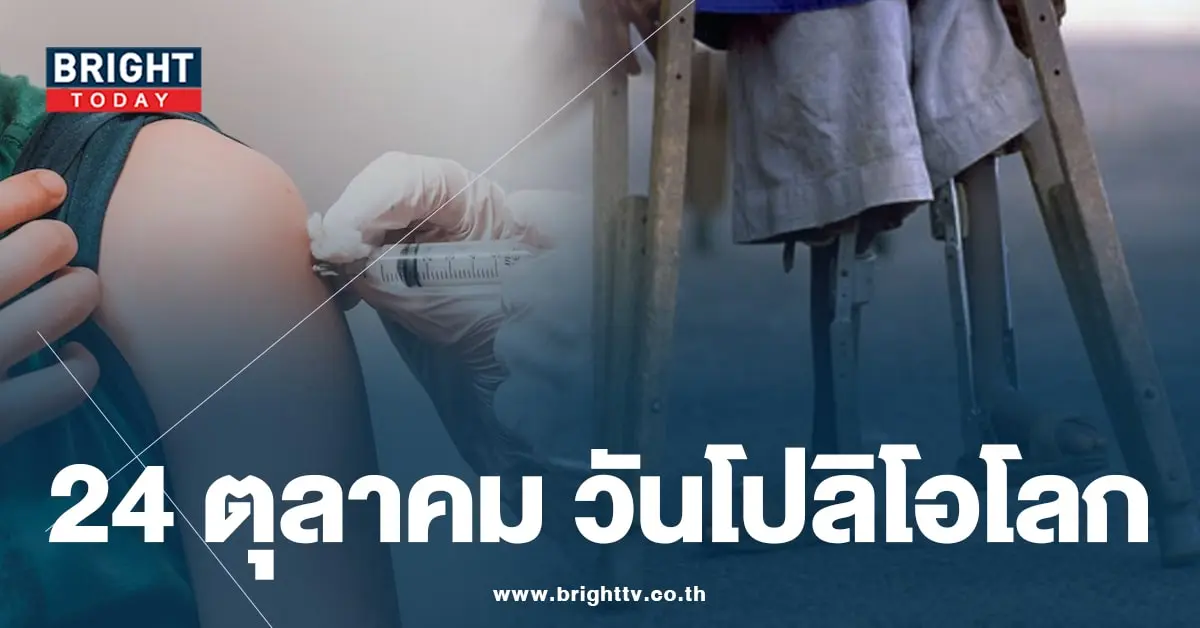 วันโปลิโอโลก 24 ตุลาคม-min (1)