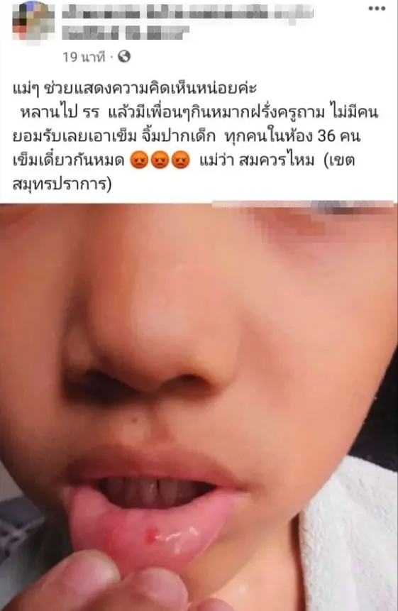 ใช้เข็มจิ้มปากเด็ก-min