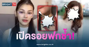 นอล์ รี่ -คู่กรณี