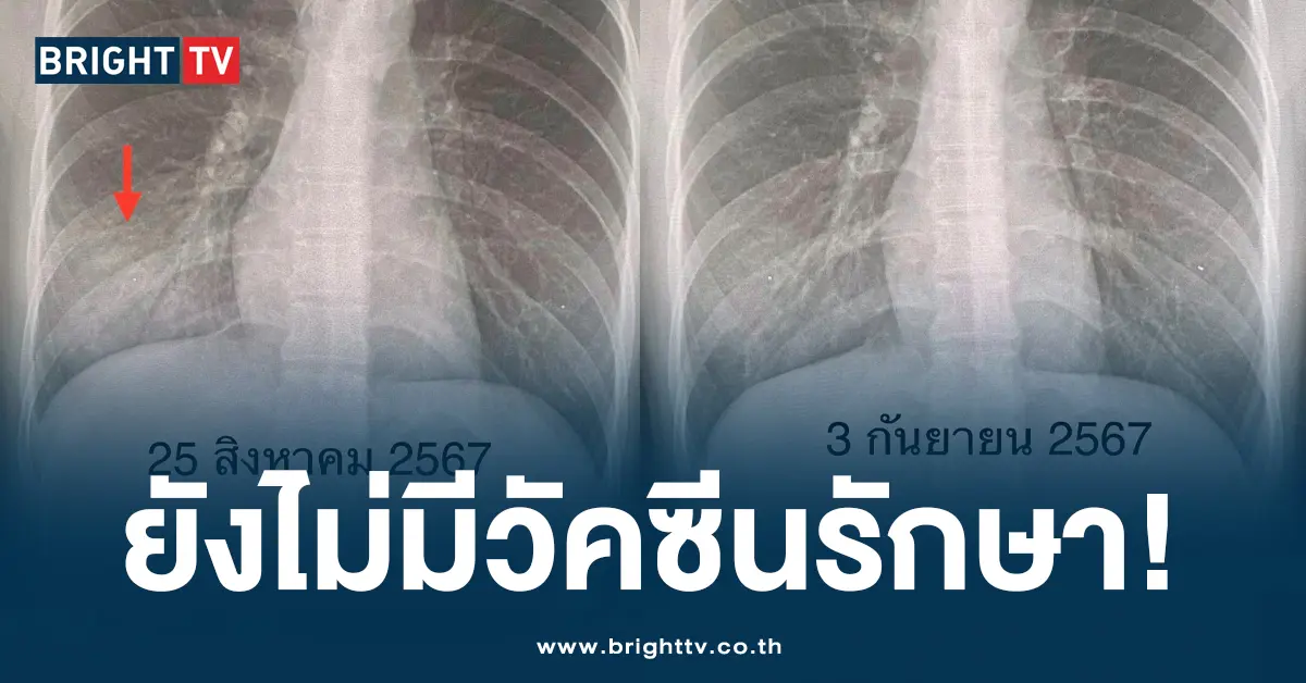 เชื้อแบคทีเรียไมโคพลาสมา