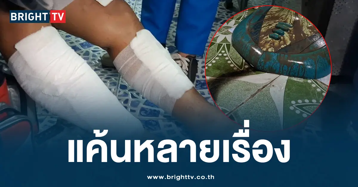 สาดน้ำกรด