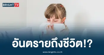 โรคไอกรน (2)-min