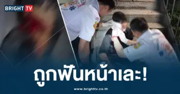 ถูกฟันหน้าเละ-ปก-min