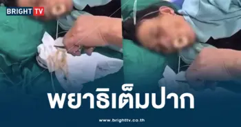 พยาธิตัวตืด