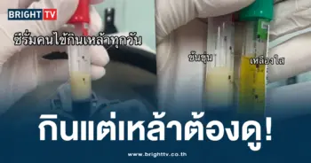 คนไข้กินเหล้า
