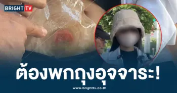 ผ่าตัดแปลงเพศ
