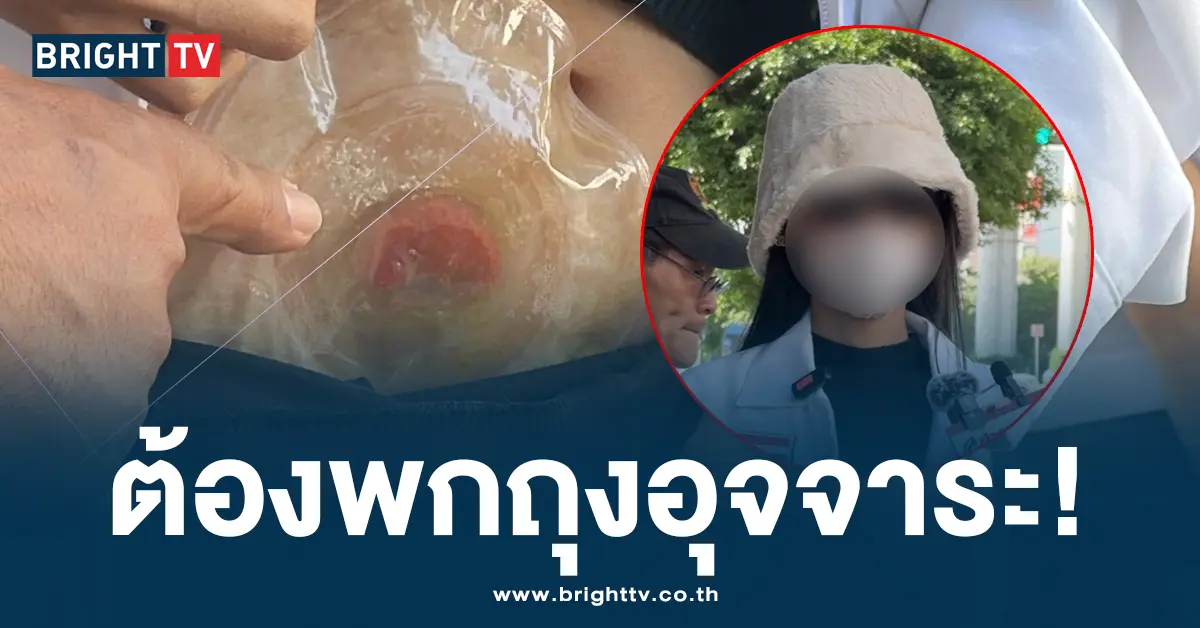 ผ่าตัดแปลงเพศ