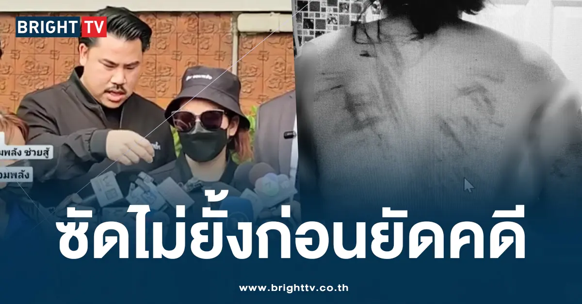 ทำร้ายลูกจ้าง