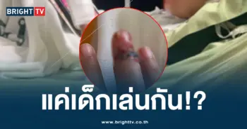 นิ้วขาด