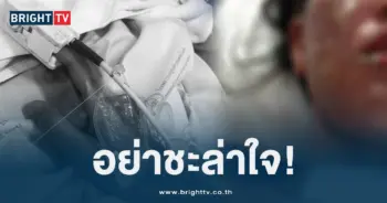 แพ้ยา (1)