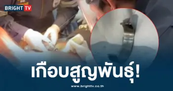หนุ่มสวมแหวนที่อวัยวะเพศตัวเอง