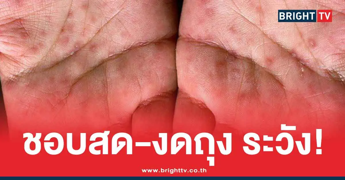 5 จังหวัด ชอบใส่สด