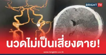 นวดคอ ทำสมองตาย