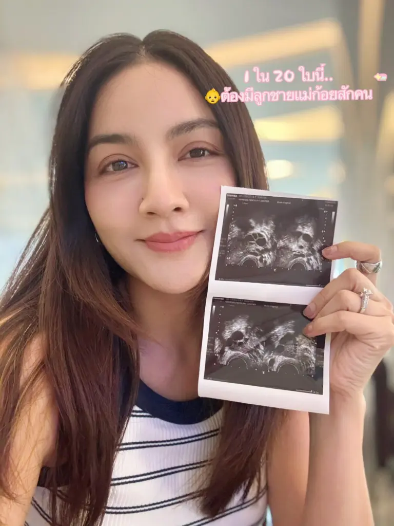 12.มีลูกยาก ฟังทางนี้! “ครูก้อย” ภรรยา “เจมส์ 0