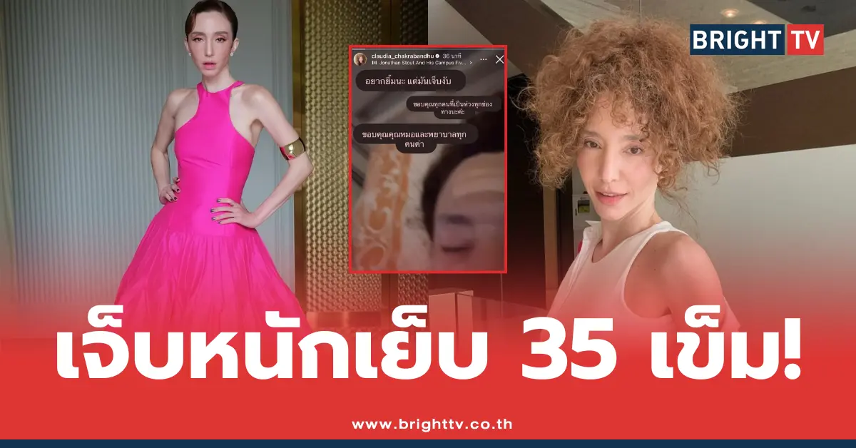 คลาวเดีย เย็บ