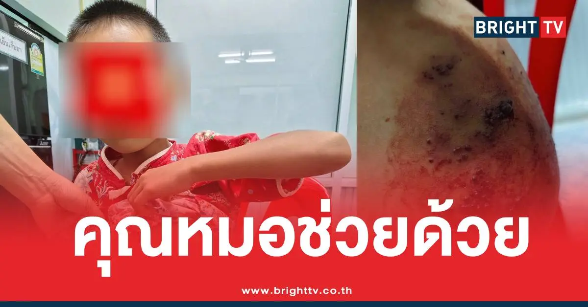 เด็กป่วยก้อนเนื้อไม่มีเงิน