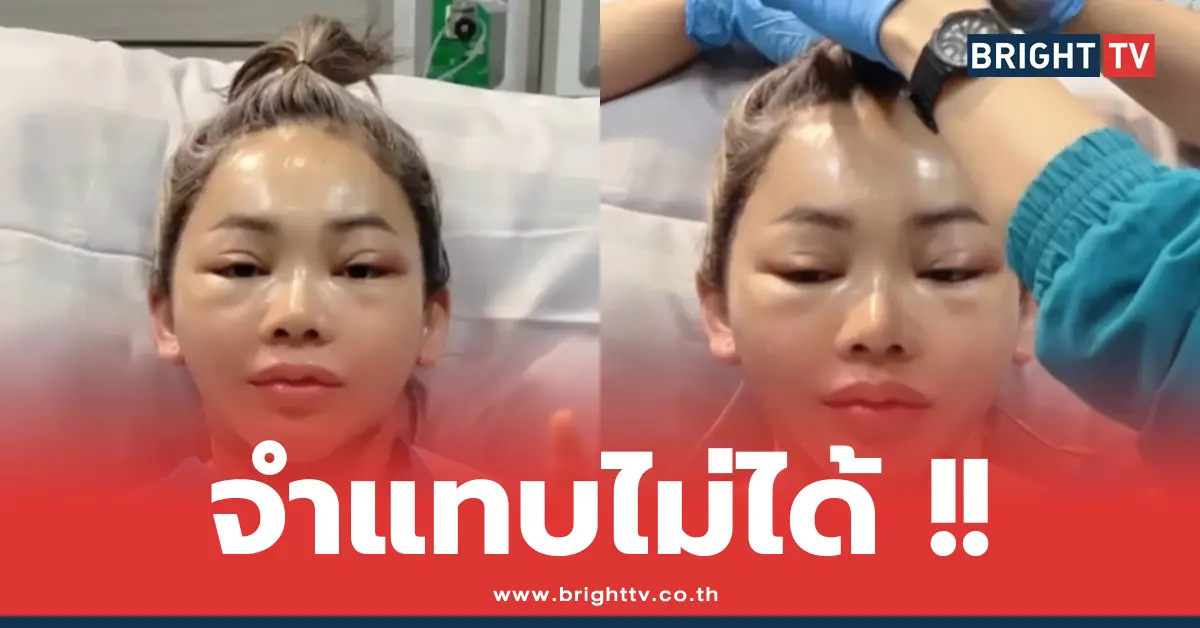 ตั๊กแตน ชลดา