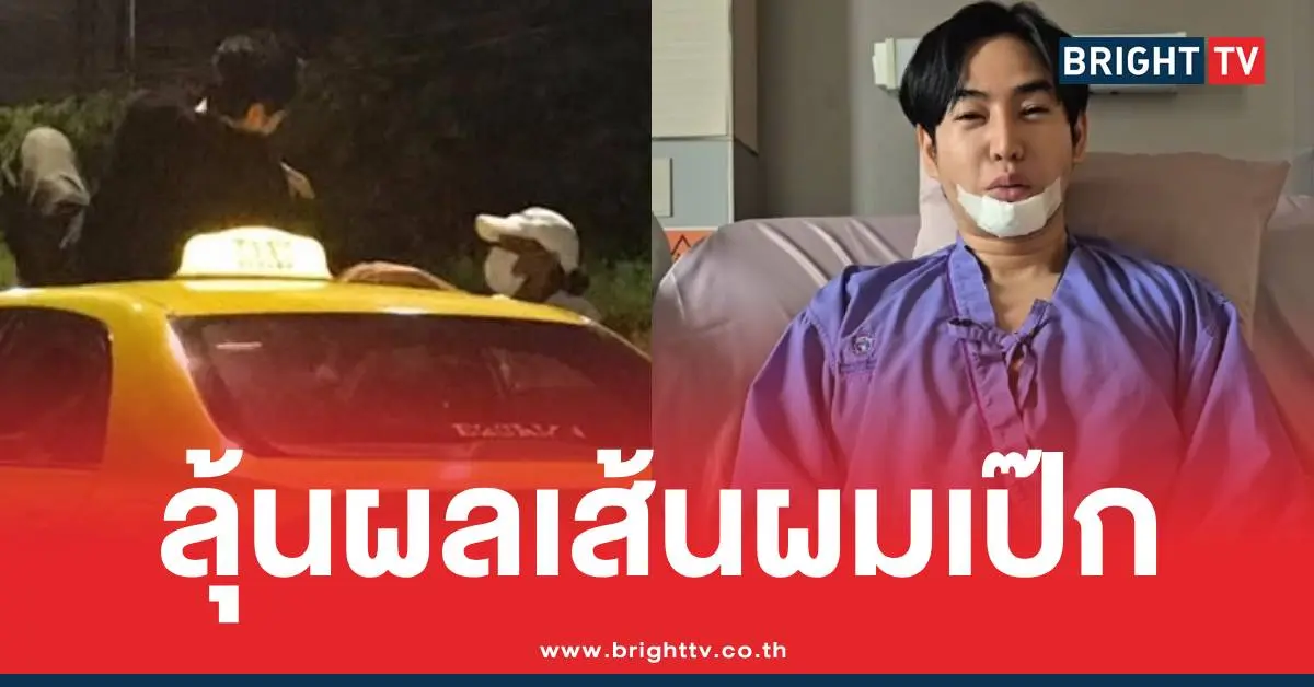 เส้นผมเป๊กผลิตโชค