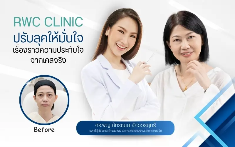 RWC Clinic ปรับลุคให้มั่นใจ