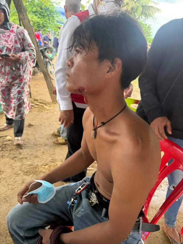 ม็อบเขมรหนองหญ้าแก้วแก๊สน้ำตา5