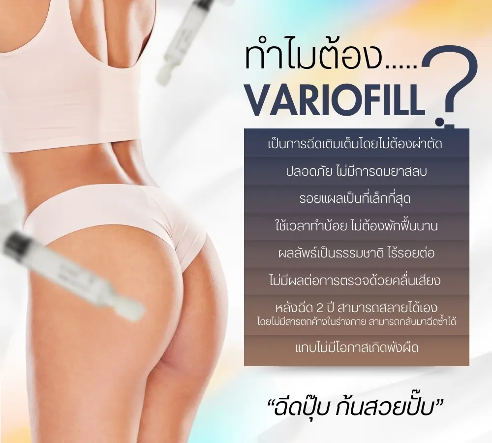 ฟิลเลอร์สะโพก เทคนิคปั้นสะโพก ปั้นสัดส่วน โดน หมอขนมที่ RWC Clinic (2)