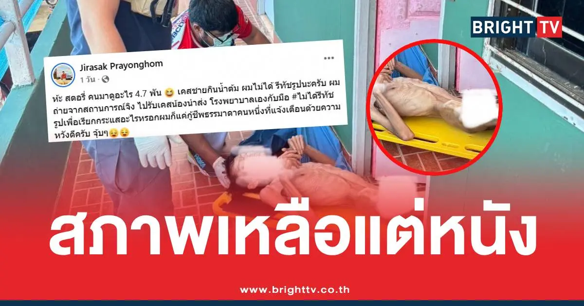 น้ำกระท่อมหนังหุ้มกระดูก