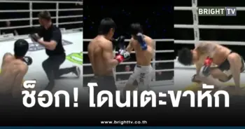 ตะวันฉายขาหักแพ้น็อค